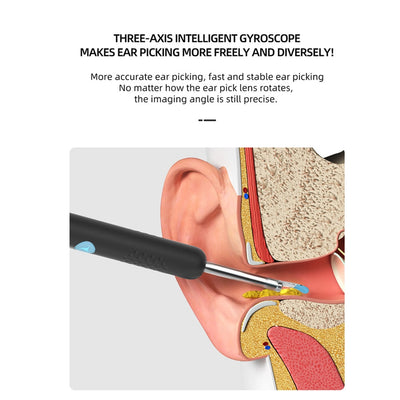 WaxWand -  Wax Otoscope